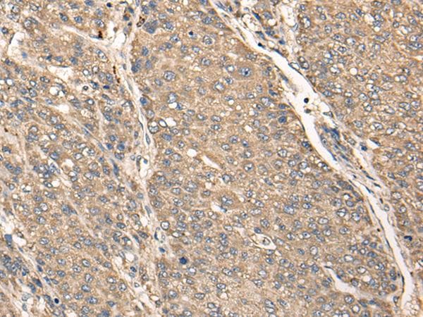 Polyclonal Rabbit anti-Human C17orf67 Antibody (IHC)