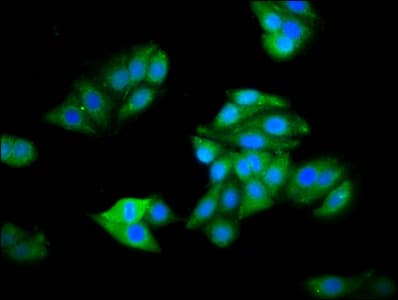 HOGA1 Antibody
