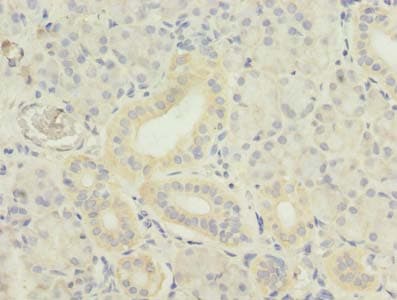 Polyclonal Rabbit anti-Human TNFSF12 / TWEAK Antibody (IHC, WB)