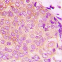 PathPlus™ HSPD1 / HSP60 Antibody (C-Terminus)