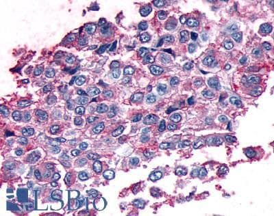 IHC-plus™ MC1R Antibody (Cytoplasmic Domain)