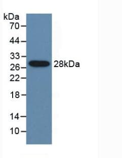 CYP2E1 Antibody (aa34-273, Cy3)