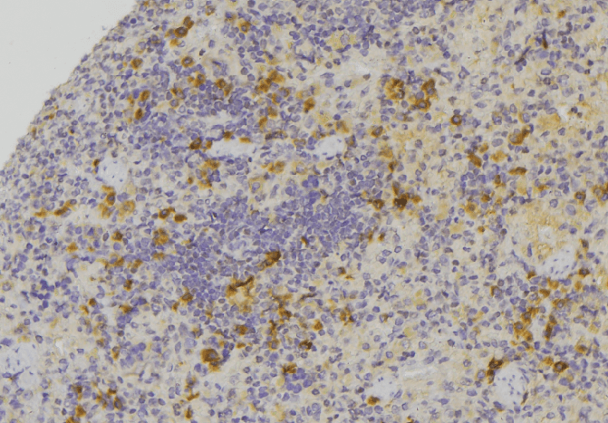 Polyclonal Rabbit anti-Human CCL24 / Eotaxin 2 Antibody (IHC, WB)
