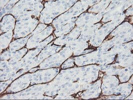 PECAM-1 / CD31 Antibody (clone OTI1B10)