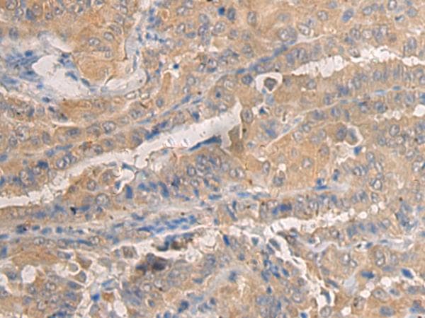 AGAP3 / CENTG3 / MRIP-1 Antibody