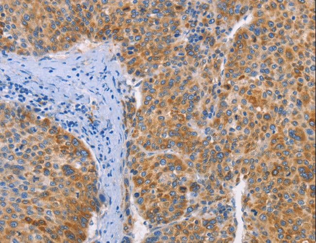 Polyclonal Rabbit anti-Human FGL1 / Hepassocin Antibody (IHC, WB)