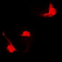 STAT5B Antibody