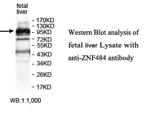 Polyclonal Rabbit anti-Human ZNF484 Antibody (aa536-819, WB)