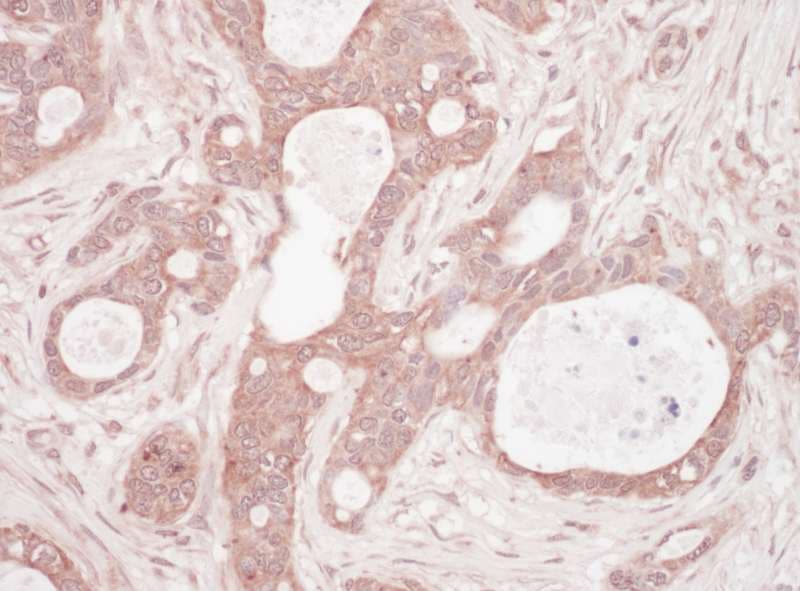 IHC-plus™ Polyclonal Rabbit anti-Human SQSTM1 Antibody (aa325-375, IHC, WB)