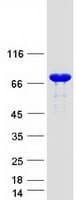 Human ARMC9 Protein (Recombinant Myc-DDK (Flag))