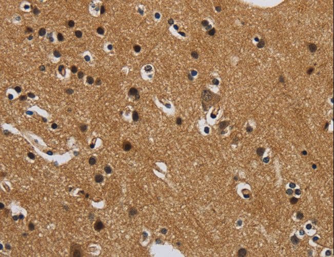 Polyclonal Rabbit anti-Human GATA5 Antibody (IHC)