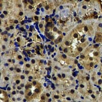 Polyclonal Rabbit anti-Human TRP32 / TXNL1 Antibody (IHC, IF, WB)