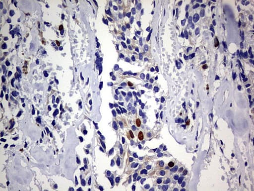 TOP2A / Topoisomerase II Alpha Antibody (aa1100-1531, clone OTI19D4)