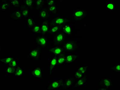 HIST1H2BN Antibody