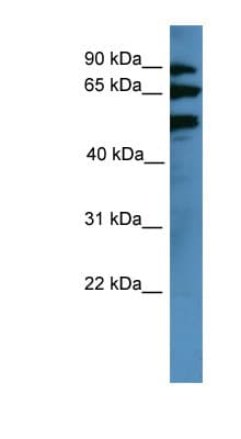BBS2 / BBS Antibody (aa315-364)