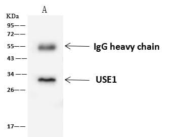Polyclonal Rabbit anti-Human USE1 / p31 Antibody (IHC, IF, WB)