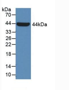 IHC-plus™ GLA / Alpha Galactosidase Antibody (aa81-429)