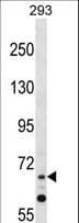 ZNF214 Antibody (aa31-59)