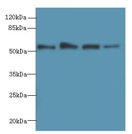 Gasdermin D / GSDMD Antibody