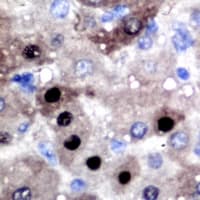 BCL11A Antibody