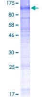Human SLC5A3 Protein (Recombinant GST)
