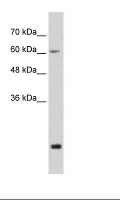 FUS / TLS Antibody (N-Terminus)