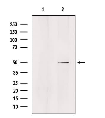 Polyclonal Rabbit anti-Human ZFYVE19 Antibody (IHC, IF, WB)