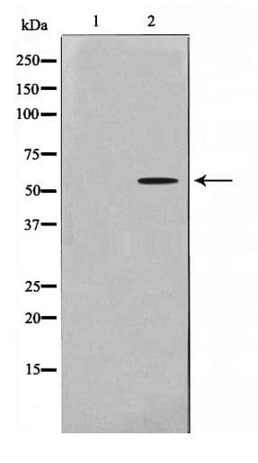 ADCK1 Antibody