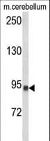 Polyclonal Rabbit anti-Human CASD1 Antibody (aa97-126, WB)