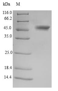 Human TSSK3 / STK22C Protein (Recombinant GST, N-terminus)