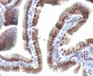 TNRC9 / TOX3 Antibody (aa200-400, clone TOX3/1123)
