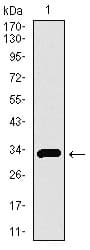 SLC27A5 / BACS Antibody (aa508-570, clone 9C4D1)