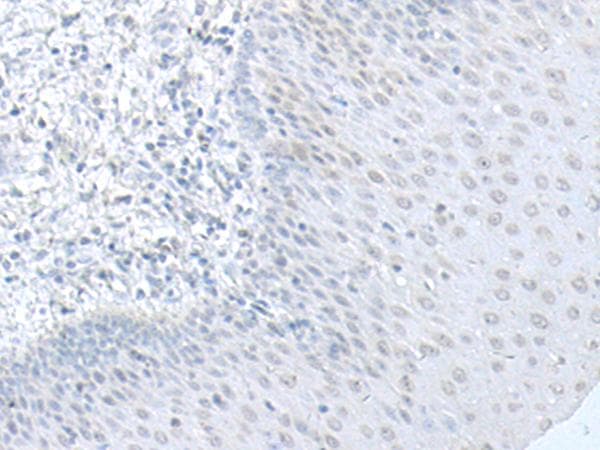 Polyclonal Rabbit anti-Human C8orf4 Antibody (IHC)