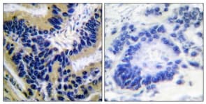 Polyclonal Rabbit anti-Human CASP3 / Caspase 3 Antibody (aa126-175, IHC)