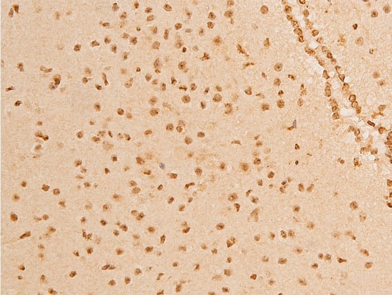 TP73 / p73 Antibody (phospho-Tyr99)
