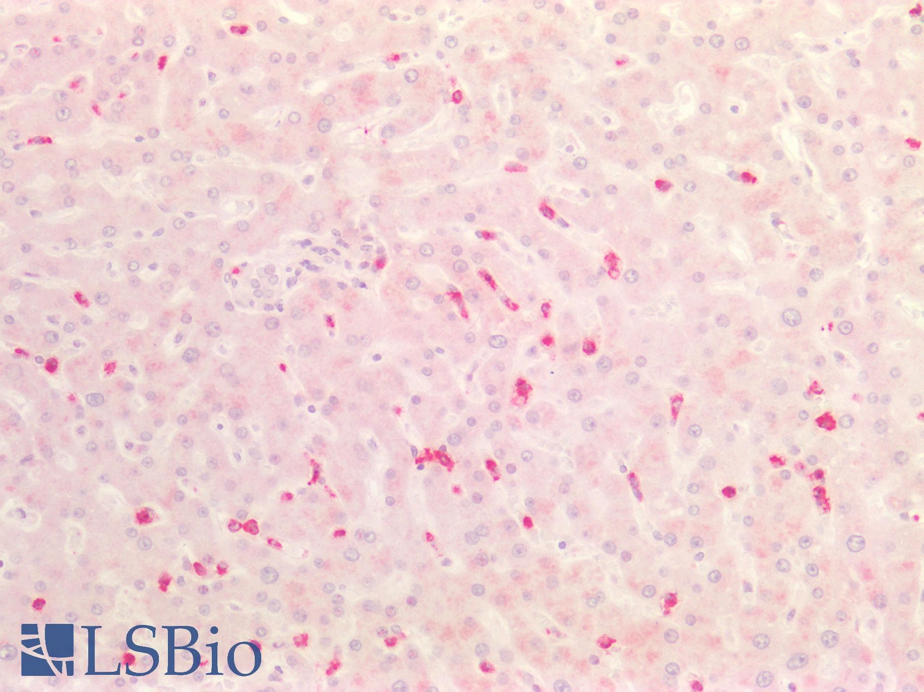 PathPlus™ HNE / Neutrophil Elastase Antibody