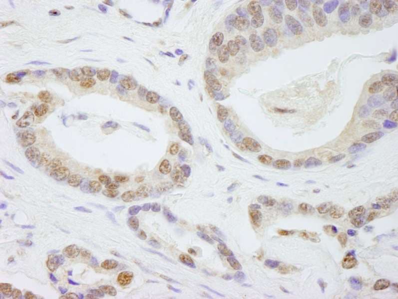 Polyclonal Rabbit anti-Human TAFII70 / TAF6 Antibody (aa627-677, IHC)