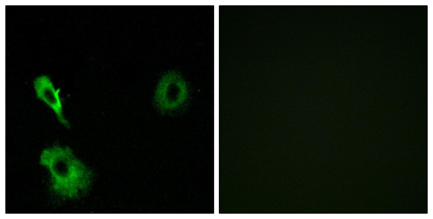 GRM7 / MGLUR7 Antibody