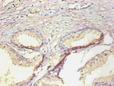 LCN2 / Lipocalin 2 / NGAL Antibody