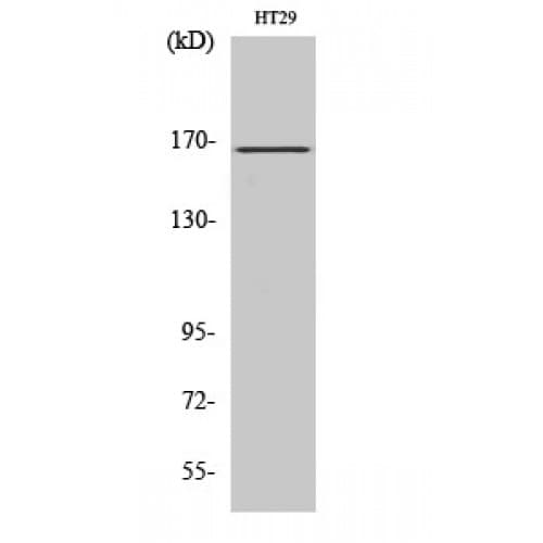 FANCD2 Antibody (160-240 aa)