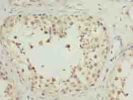 MRPL27 Antibody