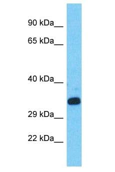 Polyclonal Rabbit anti-Human CCDC61 Antibody (aa262-311, WB)