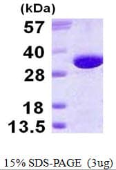 Human GGH / Gamma-Glutamyl Hydrolase Protein (Recombinant His)