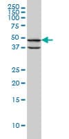 Monoclonal Mouse anti-Human PDK3 Antibody (clone 2B11, WB)