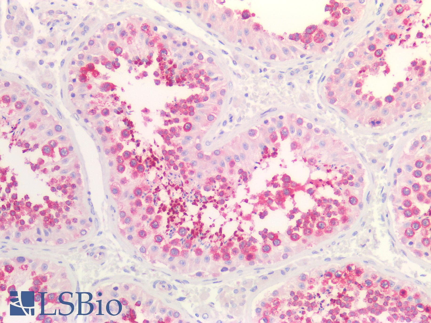 IHC-plus™ HDAC6 Antibody (N-Terminus)