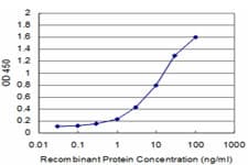 GRIA1 / GLUR1 Antibody (clone 1G10)