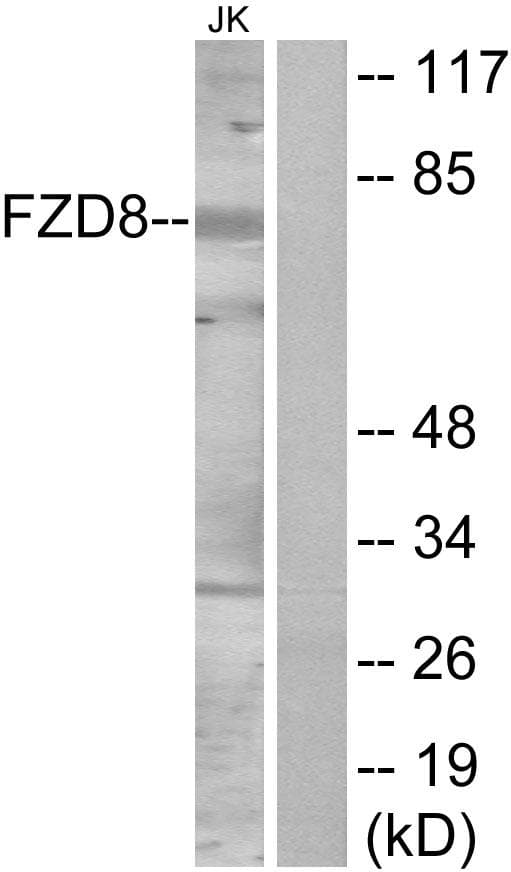 FZD8 / Frizzled 8 Antibody