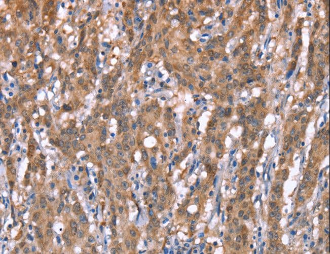 IHC-plus™ GPC6 / Glypican 6 Antibody