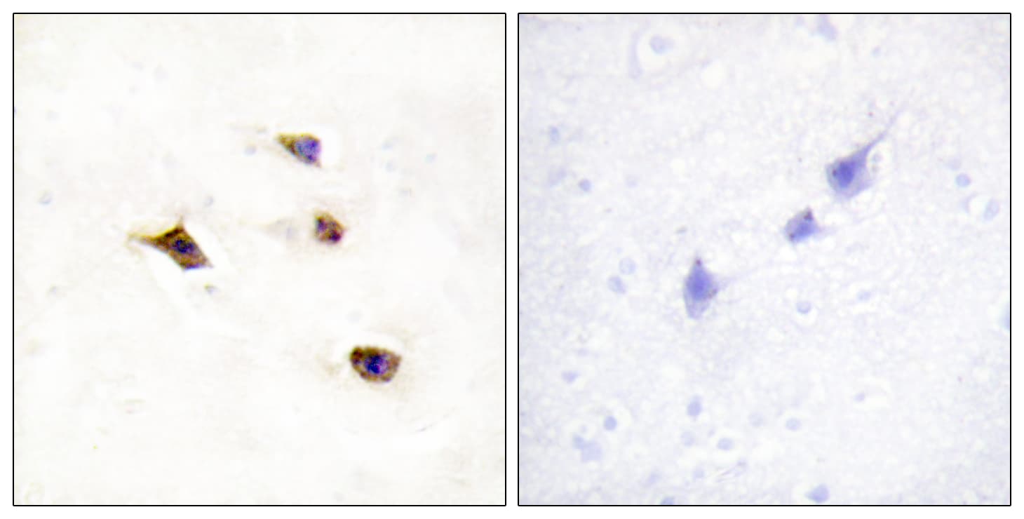 Polyclonal Rabbit anti-Human IP6K3 Antibody (aa201-250, IHC, WB)
