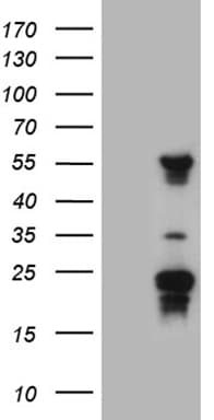 TYW2 / TRMT12 Antibody (clone OTI3C10, Carrier-free)